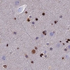Immunohistochemical staining of human cerebral cortex using Anti-DNPEP antibody HPA036398.