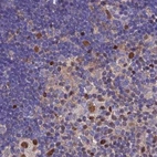 Immunohistochemical staining of human lymph node using Anti-DNPEP antibody HPA036398.