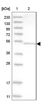 Lane 1: Marker [kDa] 230, 130, 95, 72, 56, 36, 28, 17, 11_br/_Lane 2: Human cell line RT-4