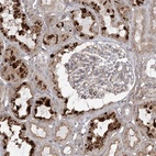 Anti-OBSL1 Antibody