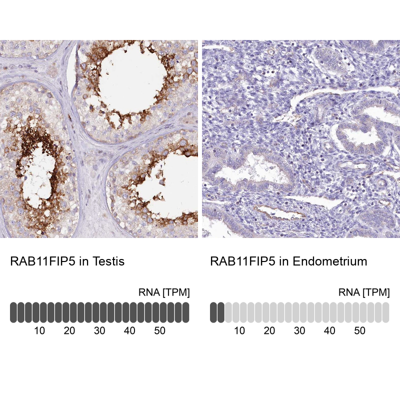 Anti-RAB11FIP5 Antibody