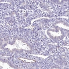 Immunohistochemical staining of human endometrium shows low expression as expected.