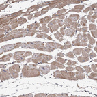 Anti-OBSL1 Antibody