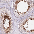 Immunohistochemical staining of human testis shows high expression.