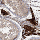 Immunohistochemical staining of human testis shows strong cytoplasmic positivity in Leydig cells.