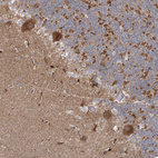 Immunohistochemical staining of human cerebellum shows strong cytoplasmic positivity in Purkinje cells.