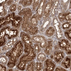 Immunohistochemical staining of human kidney shows strong cytoplasmic positivity in cells in tubules.