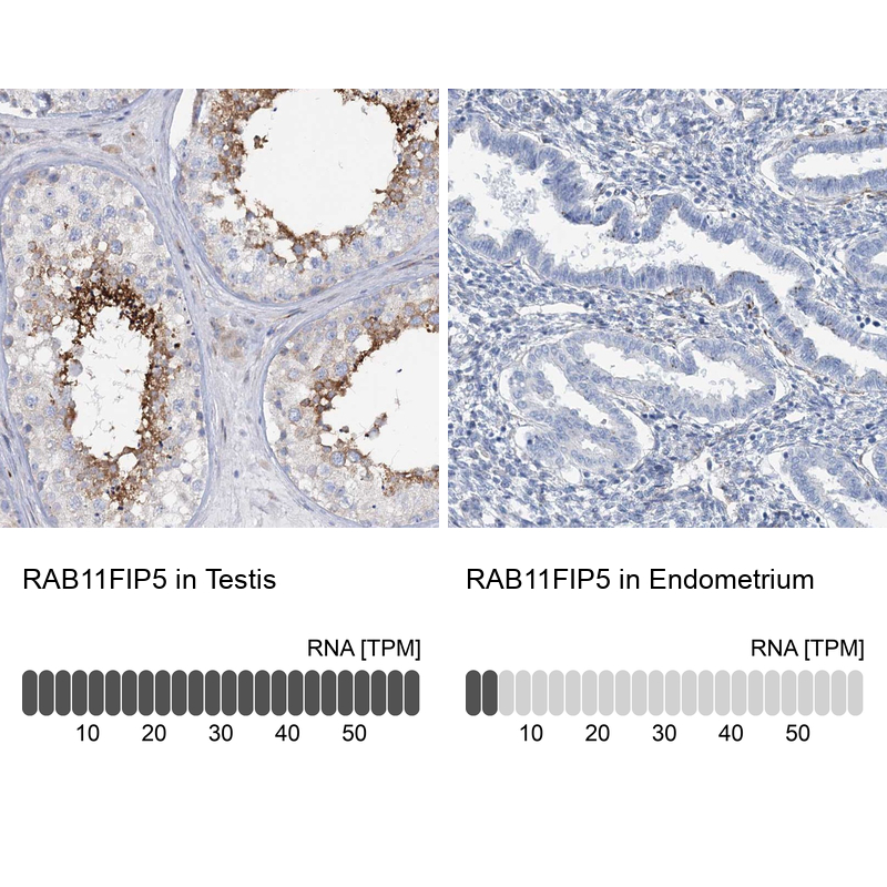 Anti-RAB11FIP5 Antibody