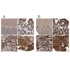 Anti-LRPPRC Antibody