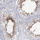 Immunohistochemical staining of human testis shows high expression.