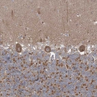 Immunohistochemical staining of human cerebellum shows strong cytoplasmic positivity in Purkinje cells.