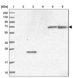Lane 1: Marker [kDa] 250, 130, 95, 72, 55, 36, 28, 17, 10_br/_Lane 2: Human cell line RT-4_br/_Lane 3: Human cell line U-251MG sp_br/_Lane 4: Human plasma (IgG/HSA depleted)_br/_Lane 5: Human liver tissue_br/_Lane 6: Human tonsil tissue