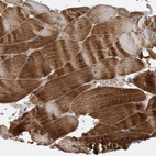 Immunohistochemical staining of human skeletal muscle shows strong cytoplasmic positivity in myocytes.