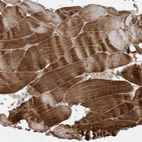 Immunohistochemical staining of human skeletal muscle shows strong cytoplasmic positivity in myocytes.