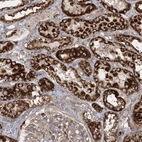 Immunohistochemical staining of human kidney shows strong cytoplasmic granular positivity in cells in tubules.