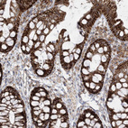 Immunohistochemical staining of human colon shows strong cytoplasmic granular positivity in glandular cells.