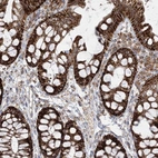 Immunohistochemical staining of human colon shows strong cytoplasmic granular positivity in glandular cells.
