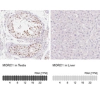 Anti-MORC1 Antibody