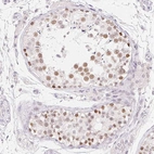Immunohistochemical staining of human testis shows moderate nuclear positivity in cells in seminiferous ducts.