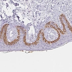 Immunohistochemical staining of human skin shows strong cytoplasmic positivity in squamous epithelial cells.
