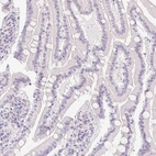 Immunohistochemical staining of human duodenum shows no positivity in glandular cells as expected.