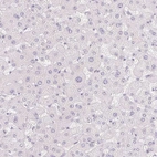 Immunohistochemical staining of human liver shows no positivity in hepatocytes as expected.