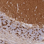 Immunohistochemical staining of human cerebellum shows strong positivity in neuropil.
