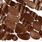 Immunohistochemical staining of human skeletal muscle shows strong cytoplasmic positivity in myocytes.