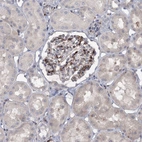 Immunohistochemical staining of human kidney shows moderate cytoplasmic positivity in cells in glomeruli.