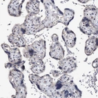 Immunohistochemical staining of human placenta shows no positivity in trophoblastic cells as expected.