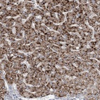 Anti-RNF25 Antibody