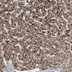 Anti-RNF25 Antibody