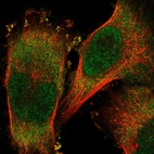 Immunofluorescent staining of human cell line U-251 MG shows localization to nucleoplasm & cytosol.