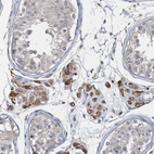 Anti-RNF25 Antibody