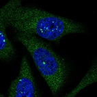 Immunofluorescent staining of human cell line U-2 OS shows positivity in nucleus & cytoplasm.