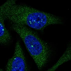Immunofluorescent staining of human cell line U-2 OS shows positivity in nucleus & cytoplasm.