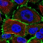 Immunofluorescent staining of human cell line U-251 MG shows localization to plasma membrane.