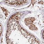 Anti-DMXL1 Antibody