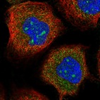Immunofluorescent staining of human cell line A-431 shows localization to nucleoli & cytosol.