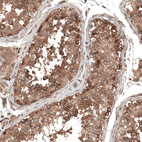 Immunohistochemical staining of human testis shows moderate to strong cytoplasmic positivity in cells in seminiferous ducts.