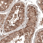 Immunohistochemical staining of human testis shows moderate to strong cytoplasmic positivity in cells in seminiferous ducts.