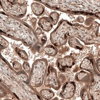 Immunohistochemical staining of human placenta shows strong cytoplasmic positivity in cytotrophoblast.