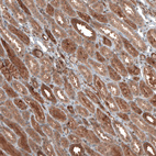 Immunohistochemical staining of human kidney shows moderate to strong cytoplasmic positivity in cells in tubules.