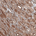 Immunohistochemical staining of human kidney shows moderate to strong cytoplasmic positivity in cells in tubules.
