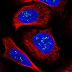 Immunofluorescent staining of human cell line U-2 OS shows localization to nucleoli fibrillar center.