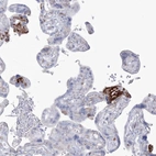 Anti-HYAL2 Antibody