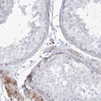 Immunohistochemical staining of human testis shows weak to moderate cytoplasmic positivity in peritubular myoid cells.