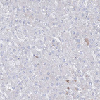 Immunohistochemical staining of human liver shows weak positivity in a small subset of hepatocytes.