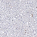 Immunohistochemical staining of human liver shows weak positivity in a small subset of hepatocytes.