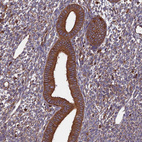 Anti-WDR1 Antibody